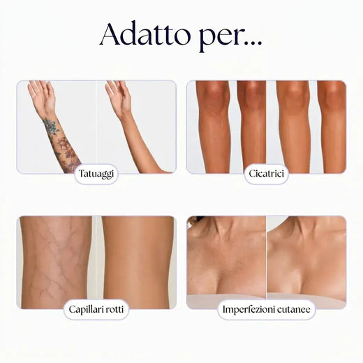 Imperfezioni cutanee