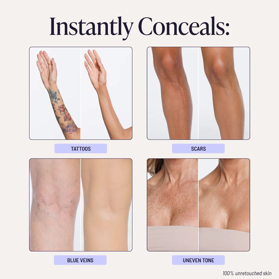 Woman confidently showing even, natural-looking skin in everyday clothing